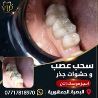 سحب عصب • حشوة جذر • البصرة الجمهورية