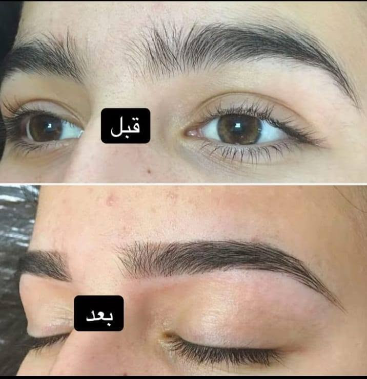 صالون ام مريم للسيدات حفافه تنظيف بشره صبغ شعر تسريح تنظيف قدم  مكياج مناسبات  اكرلك مواد تجميل مقشرات للبشره ولجسم. العنوان المفرق قرب جامع أسماء الله الحسنى مجاور مدرسة الابداع الاهليه. رقم هاتف. ***********

نص مكتوب في الصور:
- قبل
- بعد