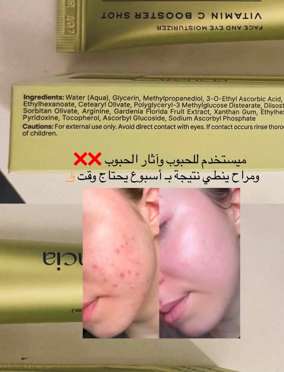 أبرز فوائد المنتج:
 تفتيح وتوحيد لون البشرة: يعالج التصبغات والبقع الداكنة لمنح البشرة مظهرًا متألقًا وصحيًا.
 إشراقة مضاعفة وترطيب خفيف: يدمج بين مركب فيتامين سي بنسبة 5% ومادة الجلوتاثيون (Glutathione) لضمان تفتيح فائق وتغذية بدون ملمس ثقيل.
 محاربة علامات التقدم بالسن: يقلل من ظهور الخطوط الدقيقة بفضل ميزة شد البشرة وتعزيز إنتاج الكولاجين.
 استخدام 2 في 1 (للوجه ومنطقة العين): تركيبة آمنة ومخصصة للاستخدام على كامل الوجه وحول العينين لتقليل الهالات السوداء والانتفاخات.
 حماية من الأكسدة والعوامل الخارجية: يوفر درعًا واقيًا ضد أضرار أشعة الشمس، التلوث، والإجهاد التأكسدي.
✨ استرجعي نضارة بشرتك وحيويتها مع Arencia Vitamin C Booster Shot! ✨
جرعة مركزة من الإشراق والجمال في منتج واحد (350 مل):
تركيبة متطورة تجمع بين فيتامين C (5%) والجلوتاثيون لتعزيز نضارة البشرة، توحيد لونها، والتخلص من التصبغات والبقع الداكنة.
🌿 لماذا ستحبين هذا المنتج؟
 عناية مزدوجة: مرطب خفيف ومثالي للوجه وحول العين لتقليل الهالات السوداء.
 شباب دائم: يقلل الخطوط الدقيقة ويعيد للبشرة المجهدة مرونتها وشدّها.
 حماية يومية: مضاد أكسدة قوي يحمي بشرتك من التلوث وأضرار الشمس.
احصلي على بشرة مشرقة، متألقة، ومفعمة بالحيوية فوراً! 💛

📌 للطلب أو الاستفسار، تواصل معي خاص 📥🛍️📦🛒"

 ☎️  واتساب ***********

#متابعة⁠ ⁠#اكسبلور⁠ ⁠#تفاعل⁠ ⁠#لايكات⁠ ⁠#دعم⁠ ⁠#فولو⁠ ⁠#اكسبلور_فولو⁠ ⁠#زيادة_متابعين⁠ ⁠#تفاعلكم_سر_نجاحنا⁠ ⁠#متابعين⁠ ⁠#لايك_كومنت⁠ ⁠#متفاعل⁠
⁠#عناية_بالبشرة⁠ ⁠#جمال⁠ ⁠#بشرة_مشرقة⁠ ⁠#منتجات_تجميل⁠ ⁠#فيتامين_سي⁠ ⁠#نضارة_البشرة⁠ ⁠#خلطات_تجميل⁠ ⁠#روتين_عناية⁠ ⁠#تجميل⁠ ⁠#بشرة_صحية
