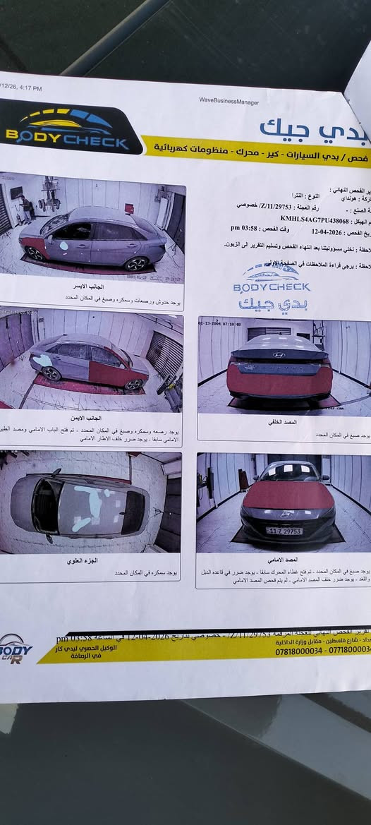 السلام عليكم
النترا 2023 وارد أمريكي حادث موضح بالصور 
مواصفات شاشه كامره بصمه رادار امامي رادار جانبي تحكمات ستيرن بصمه تشغيل عن بعد فول عدا الفتحه
سعر 135$ 
هاتف ***********
