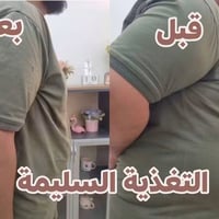 نزل ٣٦كغم • الكبد الدهني • خبير تغذية