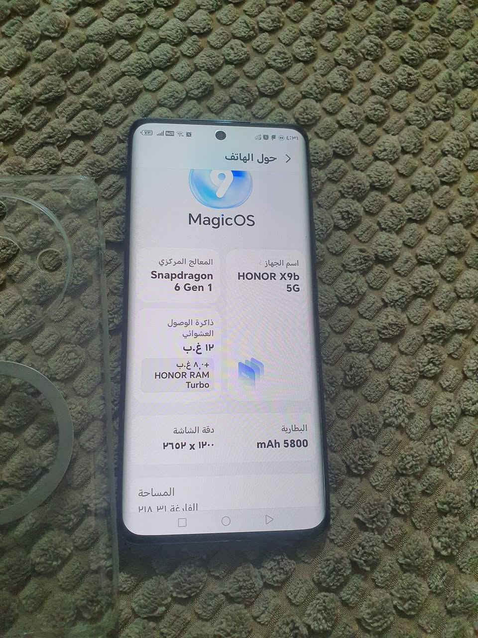 هونر X9b • رام ١٢ • بطارية ٥٨٠٠