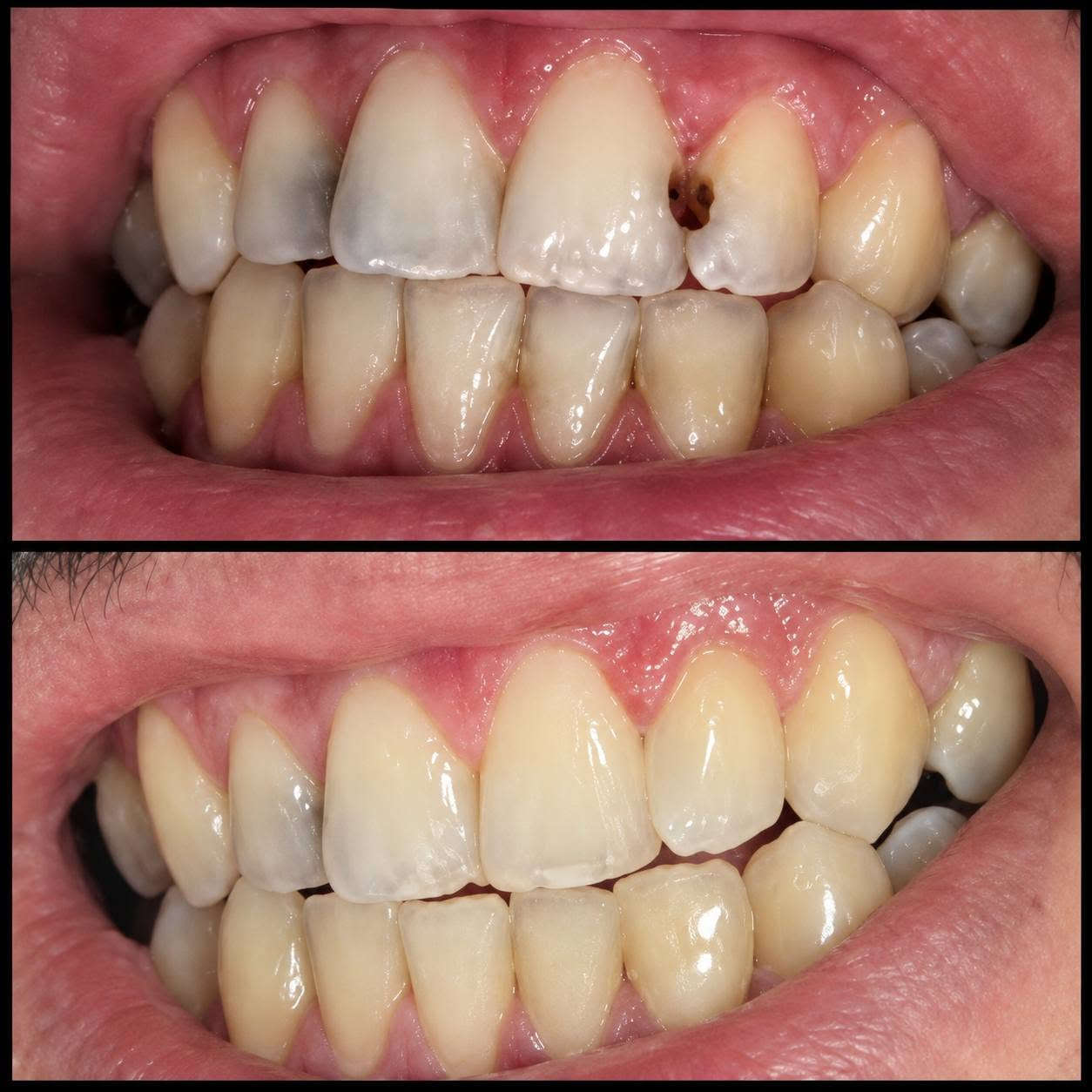 🦷 العلاج مجاني للحالات
بإشراف نخبة من الأطباء المختصين وذوي الخبرة والكفاءة، لضمان تقديم رعاية وعلاج بمستوى مهني مميز. 🤍
📍 عيادات بيارق العميد – السعدية، خلف مول الحارث
📩 للتواصل: خاص أو واتساب
📱 ***********

نص مكتوب في الصور:
- الدكتوره زهراء كريم العلاج مجاني للحالات بإشراف نخبة من الأطباء المختصين وذوي الخبرة والكفاءة، لضمان تقديم رعاية وعلاج بمستوى مهني مميز. ابتسامتك .. تستحق الأفضل قلع الاسنان والجذور المتبقيه الحشوات الضوئيه التجميليه تنظيف الأسنان من التكلسا ت وتلميعها تعويض الأسنان المفقوده بالتراكيب السنيه المتحركه عيادات بيارق العميد السعدية - خلف مول الحارث *********** للتواصل: خاص أو واتساب
- DR. AMJAD ALQAYYUM DENTAL CLINIC
