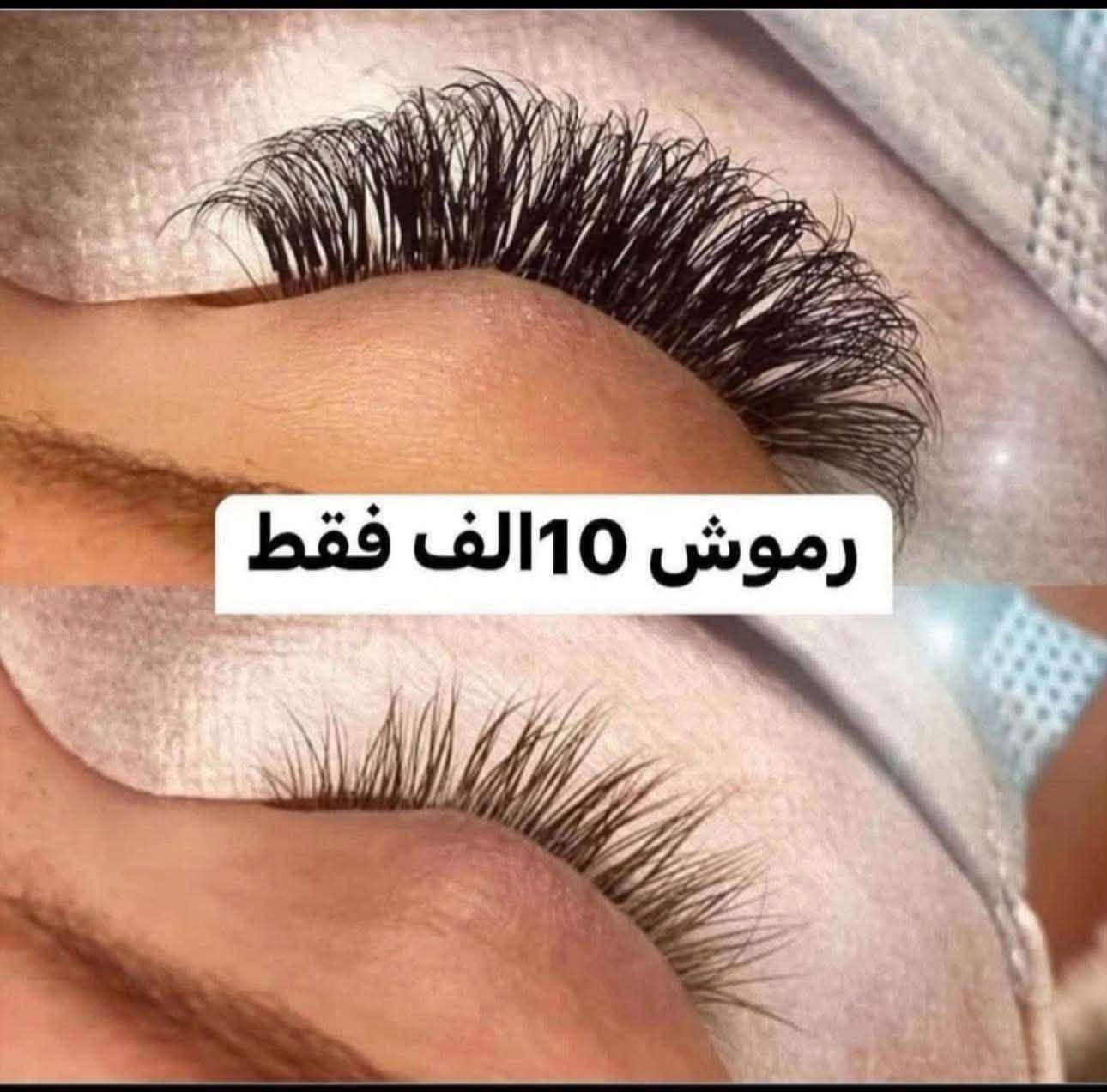 خصم ٢٥٪ • فيلر بوتكس • الزعفرانية