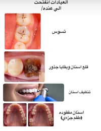 الرمادي • عيادة أسنان • العلاج مجاني