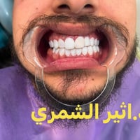 عيادة اسنان • دايركت فينيير • حي العدل