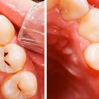 اي احد محتاج تنظيف اسنان / حشوات ضوئية/ قلع اسنان او جذور / طقم متحرك ...