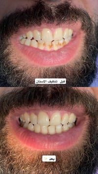 كربلاء • علاج مجاني • عيادة أسنان