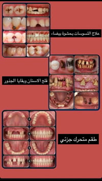 دكتورة اسنان • علاج مجاني • منطقة الامين