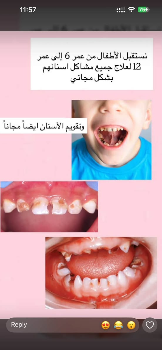 علاج الاسنان مجانًا"
السلام عليكم نعلن عن بدأ استقبال الحالات بالعيادات الخاصة بجامعة ابن سينا للعلوم الطبية والصيدلانية - مقابيل محطة وقود البياع 

قلع الاسنان
حشوات
وحشوات الجذور
تنظيف الاسنان
الاطفال حشوات وقلع وحتى تقويم
تعويض كامل وجزئي للاسنان
والعلاج مجاني تمامًا 
للتواصل على الرقم
***********

نص مكتوب في الصور:
- نستقبل الأطفال من عمر 6 إلى عمر 12 لعلاج جميع مشاكل اسنانهم بشكل مجاني وتقويم الأسنان ايضاً مجاناً
