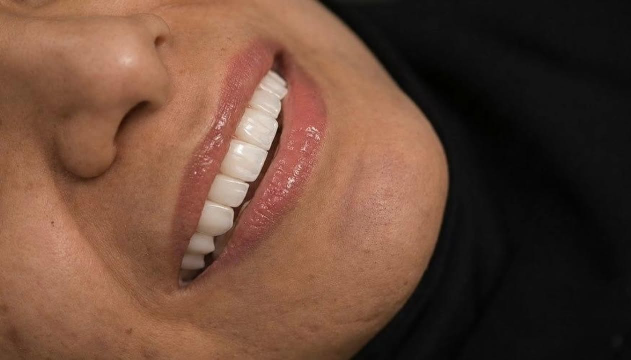 فرصة ما تتعوض

عالج أسنانك بخصومات خاصة لفترة محدودة

مراكز الشركة الطبية العالمية تمنحكم ابتسامة مشرقة 

#مراكز_الشركة_الطبية_العالمية #بغداد #تبييض_الاسنان #تقويم_اسنان #العراق

العنوان : طويريج _الشارع العام_مجاور نقابة المعلمين _مقابل المكتبة العامة _مجمع الحارث الطابق الثاني 

رقم الهاتف ***********
                 ***********
