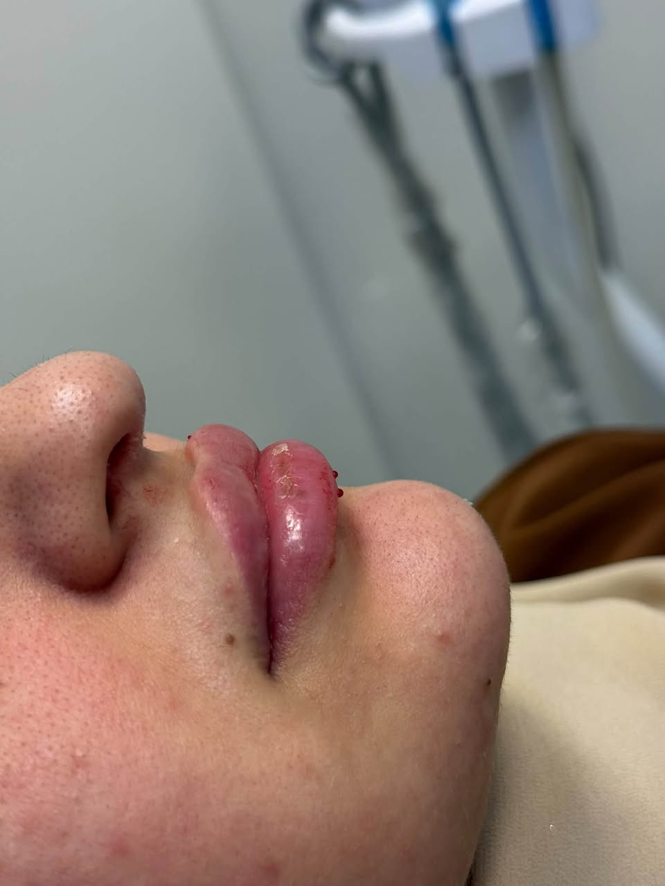 عيادة بتول • تجميل لاجراحي • البساتين