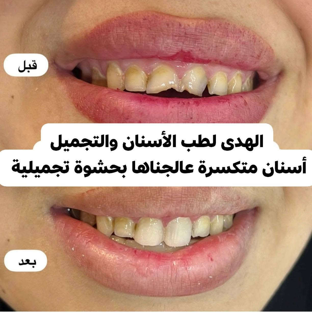عيادة الهدى • أسنان وتجميل • تقاطع الجدوع