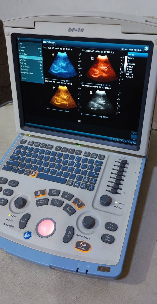 سونار محمول • ميندراي Dp10 • مكتب المهندس