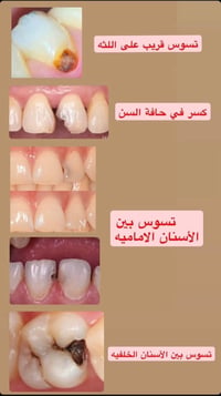 عيادات جامعة واسط • علاج أسنان • أجور رمزية