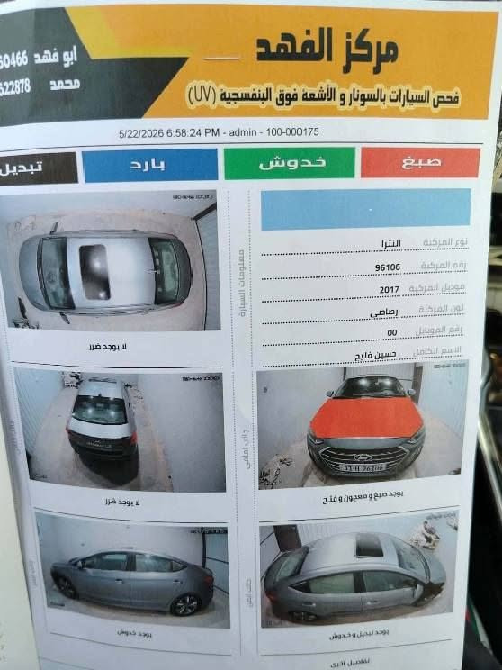 سلام عليكم
النترا 17 وارد امريكي مكينه 2000  موضح كلشي بسونار للستفسار 
هذا الرقم *********** العنوان الديوانيه الحمزه الشرقي السعر 115 قفل
