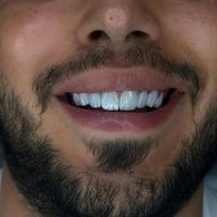 "الابتسامة المثالية حلم كل إنسان، اكتشف جمال ابتسامتك بخدماتنا."  متوا...