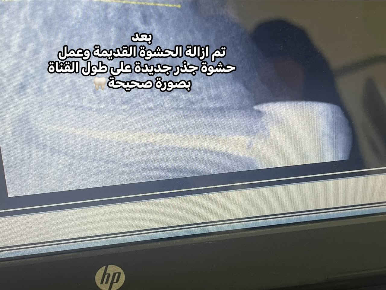 عيادة الجمال لطب وتجميل الأسنان
 للحجز والاستفسار 

***********
***********
