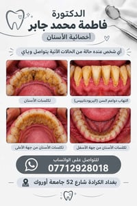 أخصائية أسنان • تكلسات الأسنان • الكرادة