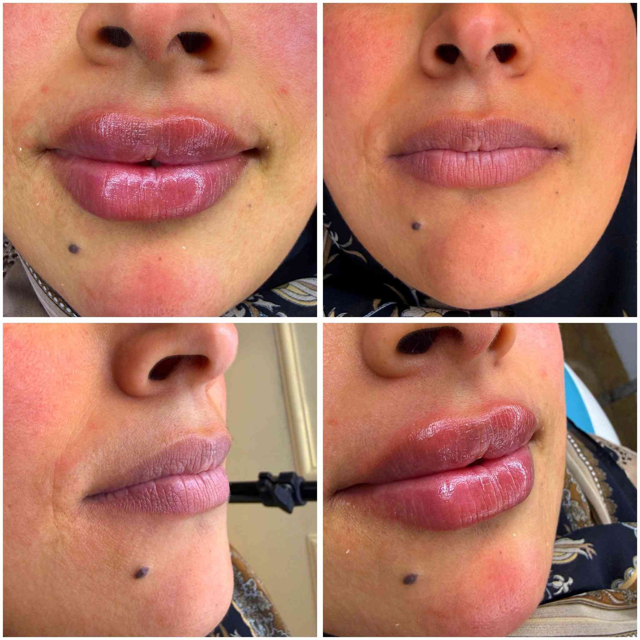✨ قريبًا… افتتاح قسم الجلدية والتجميل ✨

في Nile Beauty نحضّر لكم تجربة جديدة ومتكاملة للعناية بالجمال والبشرة. 🤍

🌸 خدمات جلدية وتجميلية
✨ عناية متخصصة ولمسات جمالية تليق بكم

ترقّبوا الافتتاح قريبًا… والمفاجآت أجمل! 💎

📍 الموقع: النعمانية
📞 للحجز والاستفسار: *********** – ***********

NILE BEAUTY
جمالك… ثقتك… إشراقتك ✨
