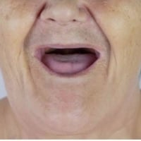 علاج مجاني • تركيبات أسنان • كبار السن