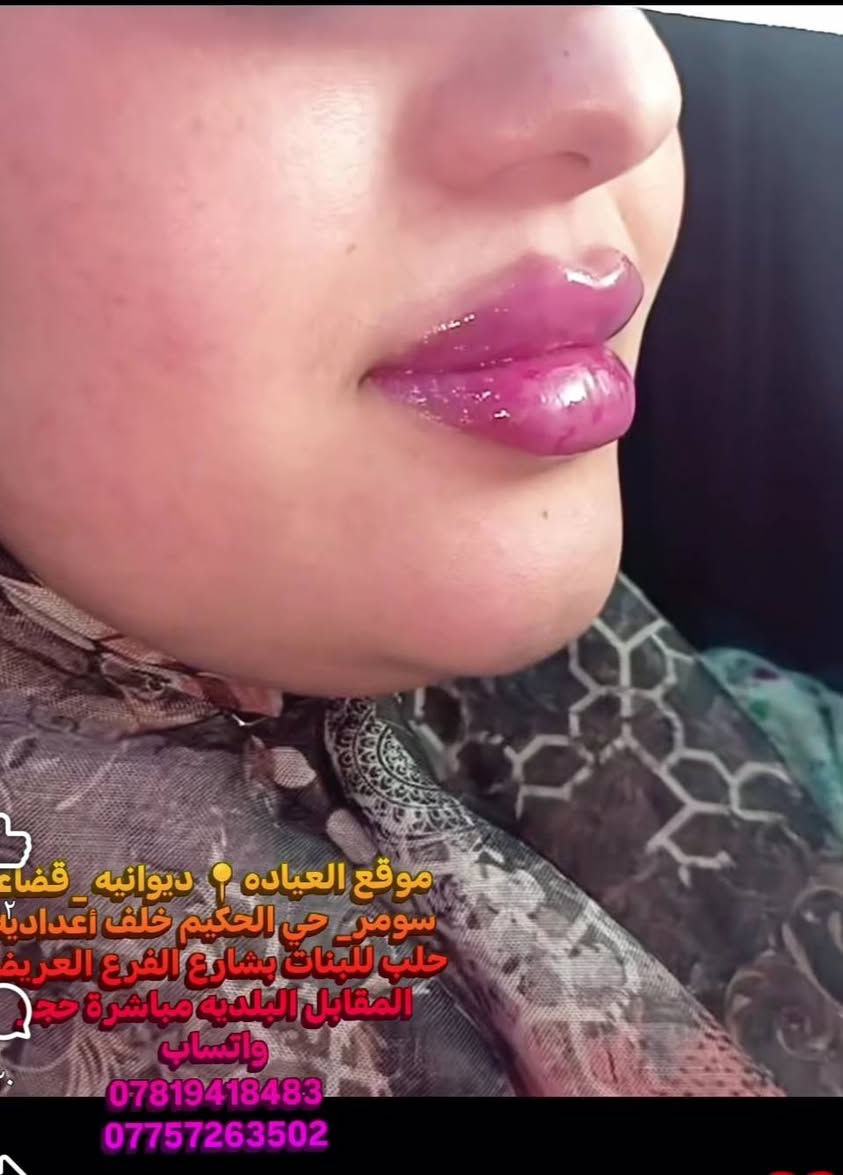 عيادة رسل • فلر شفه • قضاء سومر