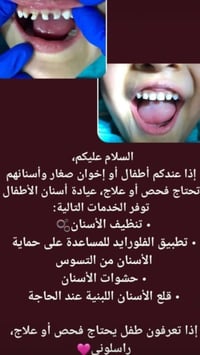 عيادة أسنان أطفال • تنظيف أسنان • فلورايد