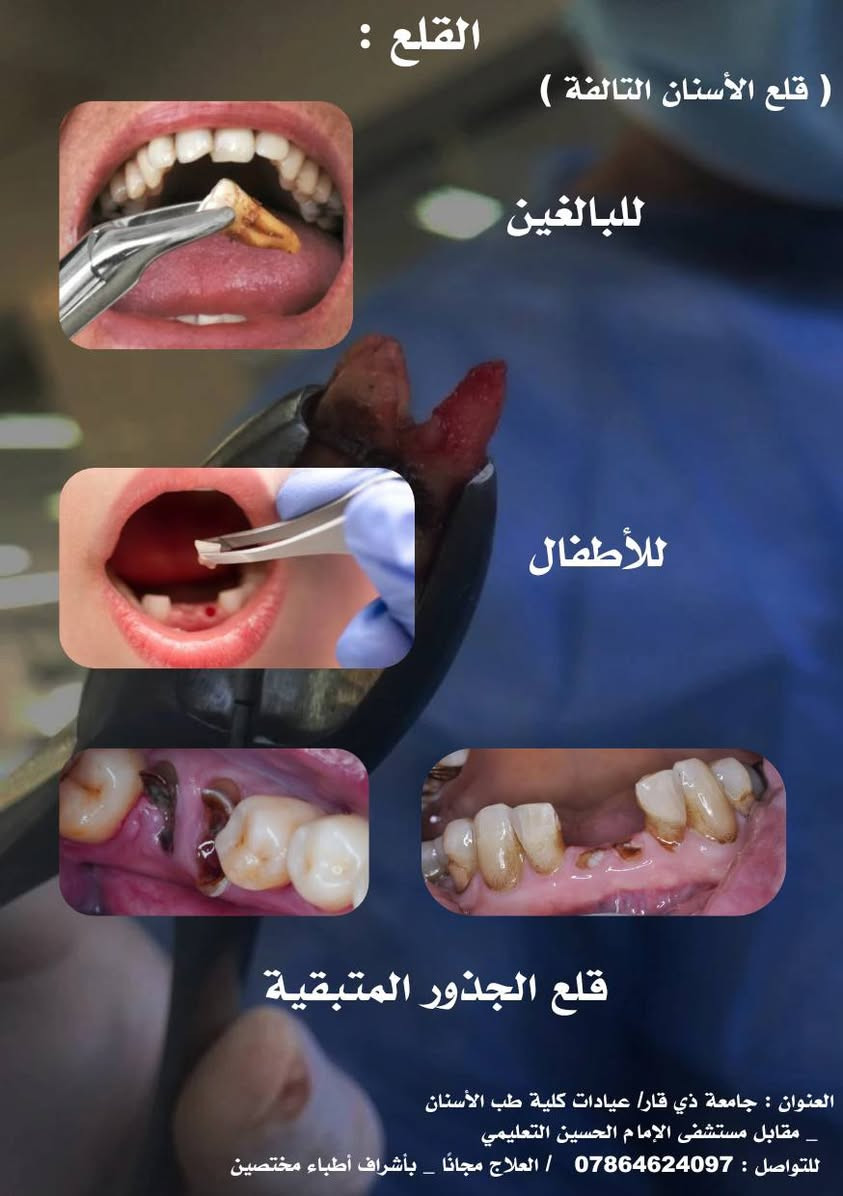 معالجة مجانية • حشوة ضوئية • قلع أسنان