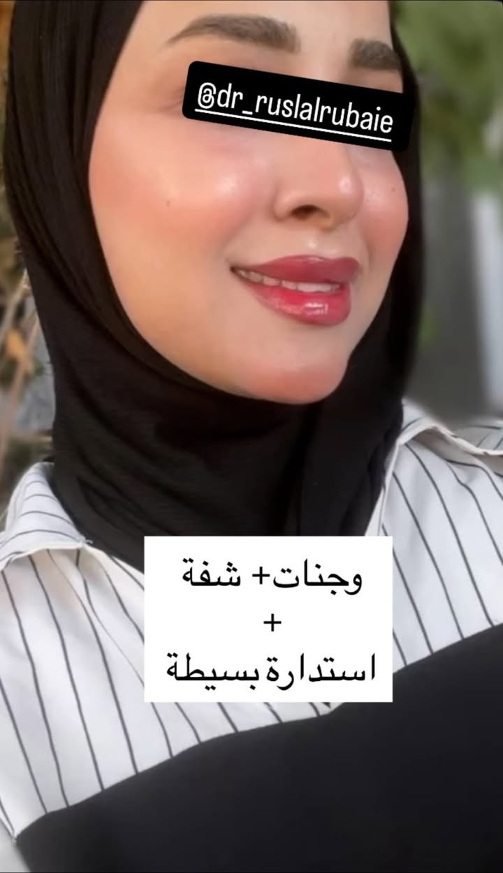رڤيوات مراجعاتي الكيكات فرع بغداد وفرع المسيب
مراجعاتي فرع المسيب كلش حابين عروض فرحة الزهرة وموسم الاعراس 🍒💉 لواكدر ابقالكم اسبوع كامل حتى الكل يلحك ويكدر يسوي بس للاسف مااتواجد فقط ايام معينة بالمسيب ولهذا العروض على طلبكم موجودة 💗
💗💉

شنو رأيكم بالنتائج والجمال ✨ 

للاستفسار اكثر دايركت مسج انستكرام او فيسبوك https://www.instagram.com/p/DbWWdUhsNAt/?igsi=Z2EwenVjcm5rOXFu

DrRusl Alrubaie

والاستفسار عن العروض والحجز المسبق ومواعيد تواجدي داخل العياده التواصل يكون واتساب فقط مسجات ***********
