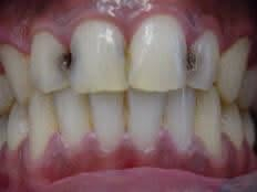 مجاناً 🦷
علاج الأسنان
 ، حشوات ضوئيه ، تنظيف الأسنان ، قلع ، اطقم للأسنان المفقودة (اسعار رمزيه جداً )
عيادات جامعة النور 📍

للتواصل على الخاص او واتساب ***********
