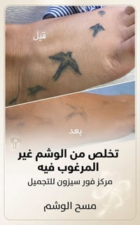 مسح الوشم • فور سيزون • الكوت الهوره