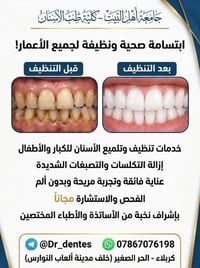 إزالة التكلسات • تلميع أسنان • فحص مجاني