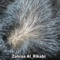 سيروم خصلة • ينبت الفراغات • عشبي ١٠٠٪