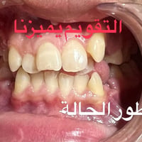 تقويم الاسنان • حالات معقدة • الكرخ نفق الشرطة