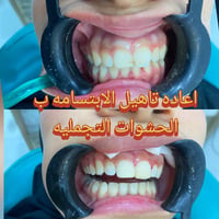 د.محمد قاسم العبودي • إعادة تأهيل الابتسامة • مركز برو
