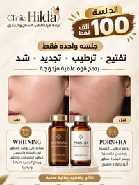 تفتيح البشرة • PDRN • عيادة هيلدا