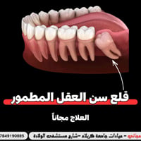 قلع سن العقل • علاج مجاني • عيادات جامعة كربلاء