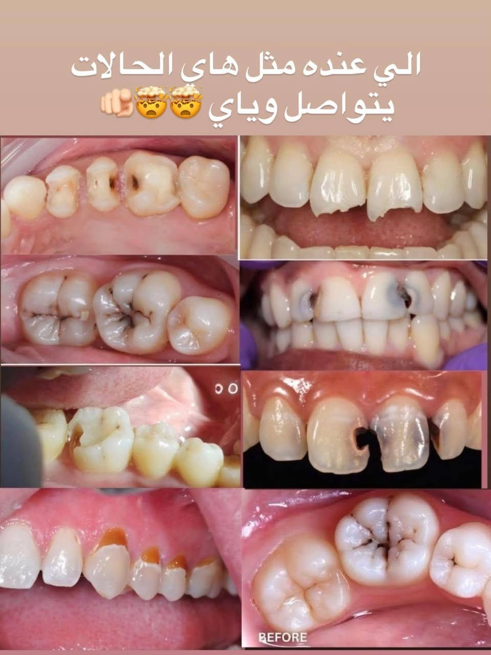 الجامعة الوطنية • علاج مجاني • تنظيف أسنان
