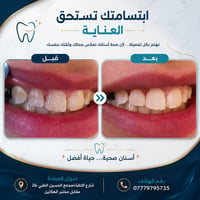 ✨✨ابتسامتك هي اولويتنا ✨✨ نحن نضمن لك الحصول على افضل النتائج في عيادت...