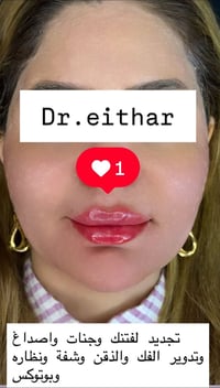 كونتور الوجه • بوتوكس • تجديد الوجه