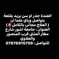 خلع سن • علاج مجاني • جامعة اشور