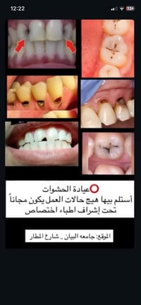 مجاني • جامعة البيان • قلع تنظيف حشوات