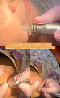 عيادة الهدى • تجميل لا جراحي • قلعة سكر/تقاطع الجدوع