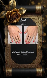 فيلر • طراوت ايديك • إزالة تجاعيد
