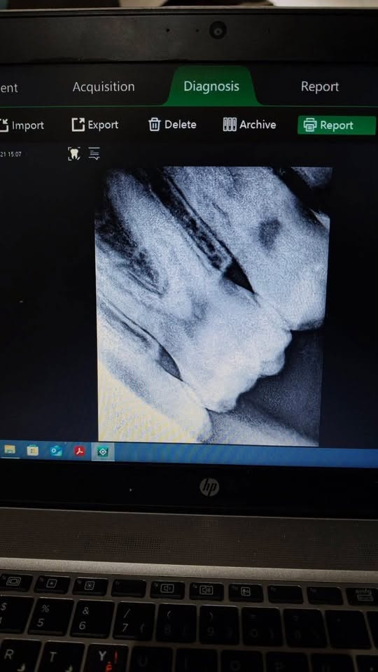 سنسر اشعه s2
شركة ڤيكير ماعوف شٌنـو    غير مستخدم السعر خاص او واتساب ***********
