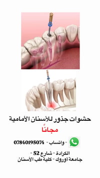 حشوات جذور • مجانا • الكرادة