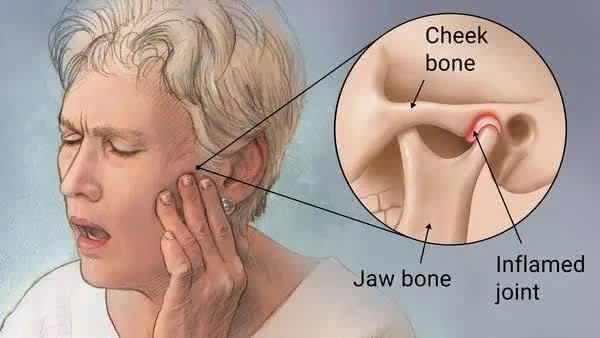 كربلاء الجمعيه • حشوات دائمة • علاج مجاني