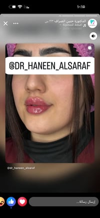 دكتورة حنين • الكوت • عيادة تجميل