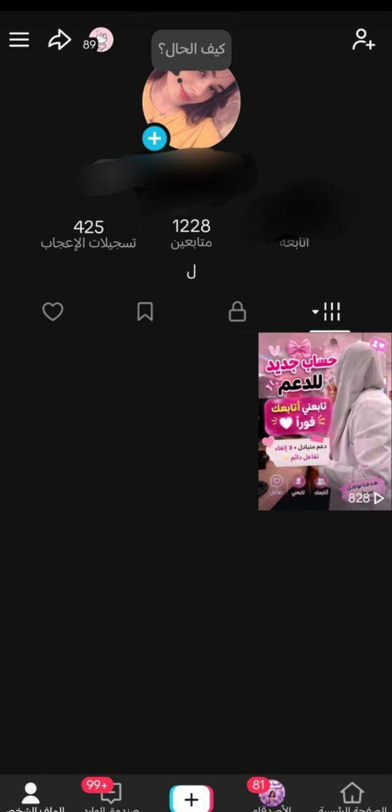 السلام عليكم
اخر حسابين للبيع 

فول تفاعل كل يوم يتغير رقم ويصعد الحساب✅

ويفتح بث شغال ✅

8ك 
1ك

ربط نضيف بنفس لحضه يتحول حساب لك

التعامل فقط 
وجه لوجه 
او ماستر غيرها لاتراسلني رجاءاً

رقمي موجود  اتصال او واتس
***********
