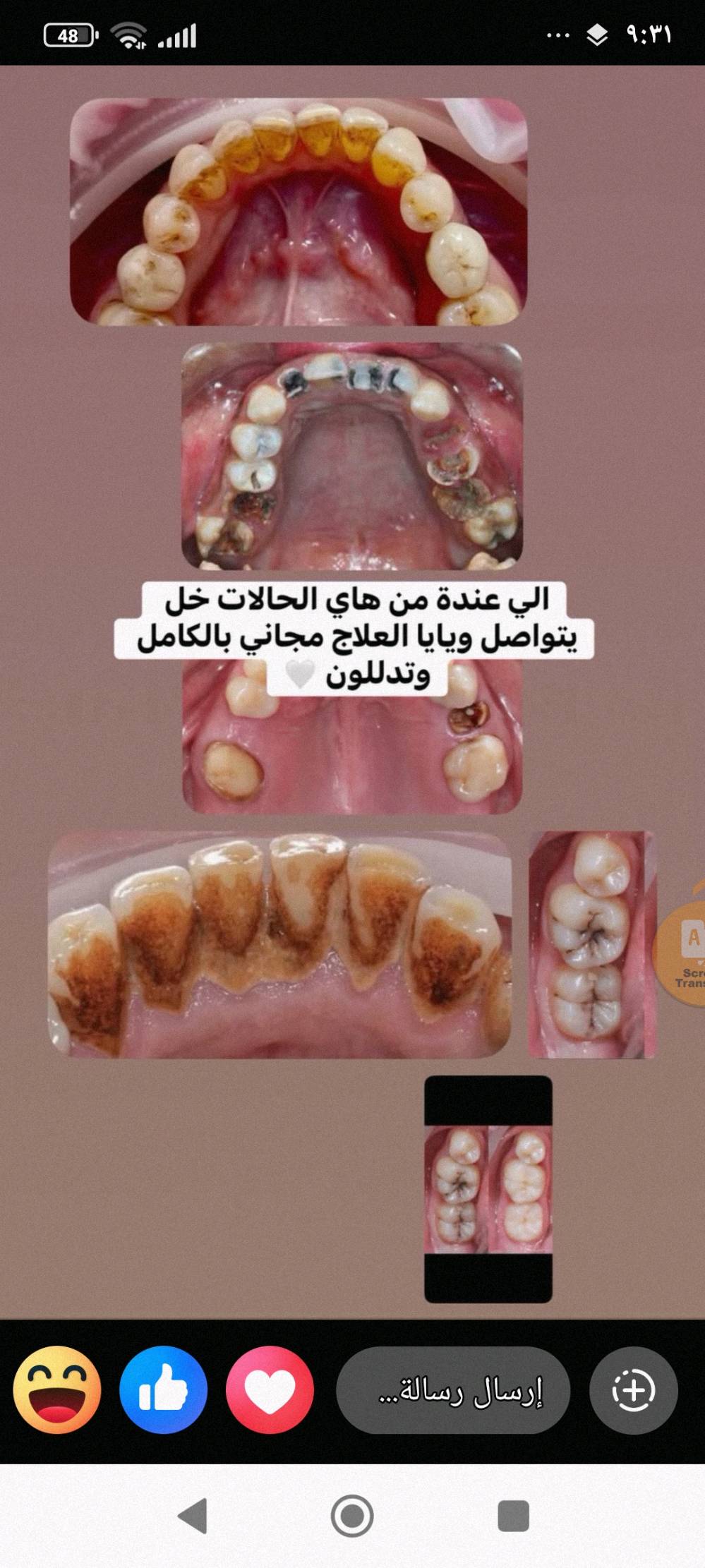 نبدأ باستقبالكم لإجراء علاجات الأسنان مجانًا ✨
وتحت إشراف كادر تدريسي مميز 👨🏻‍⚕️

🔹 الحشوات التجميلية
🔹 تنظيف الأسنان
🔹 قلع الأسنان
🔹 تعويض الأسنان المفقودة

📍 داخل عيادات جامعة الهادي
📌 الدورة – شارع 60

للحجز والاستفسار:
📞 ***********